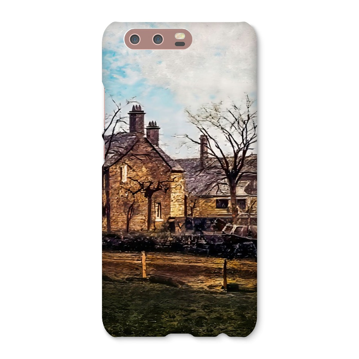 Abbey Farm, Abbey Hulton Snap Phone Case